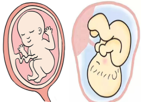 L0030大班语言活动《妈妈的肚脐》视频+教案+绘本课件+配音-幼师资源库
